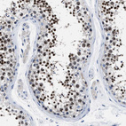 Immunohistochemical staining of human testis shows strong nuclear positivity in cells in seminiferous ducts.