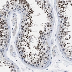 Immunohistochemical staining of human testis shows strong nuclear positivity in cells in seminiferous ducts.