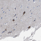 Immunohistochemical staining of human cerebral cortex shows strong cytoplasmic positivity in neuronal cells.