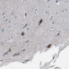 Immunohistochemical staining of human cerebral cortex shows strong cytoplasmic positivity in neuronal cells.