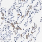 Immunohistochemical staining of human lung shows moderate cytoplasmic positivity in macrophages.