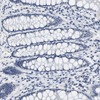 Immunohistochemical staining of human rectum shows no positivity in glandular cells as expected.