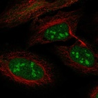 Immunofluorescent staining of human cell line U-2 OS shows localization to nucleus, nucleoli & vesicles.
