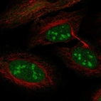 Immunofluorescent staining of human cell line U-2 OS shows localization to nucleus, nucleoli & vesicles.