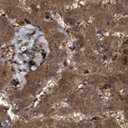 Immunohistochemical staining of human liver using Anti-GCC1 antibody HPA021323.