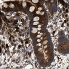 Immunohistochemical staining of human colon using Anti-GCC1 antibody HPA021323.
