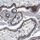 Immunohistochemical staining of human placenta shows high expression.