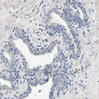 Immunohistochemical staining of human prostate shows low expression as expected.