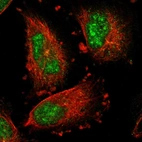 Anti-IER5L Antibody