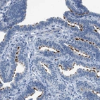 Anti-CFAP77 Antibody