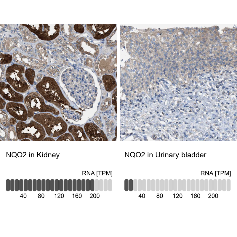 Anti-NQO2 Antibody