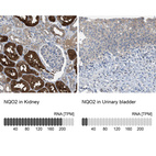 Anti-NQO2 Antibody
