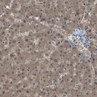 Immunohistochemical staining of human liver shows moderate cytoplasmic positivity in hepatocytes.