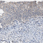 Immunohistochemical staining of human urinary bladder shows low expression as expected.