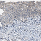 Immunohistochemical staining of human urinary bladder shows low expression as expected.