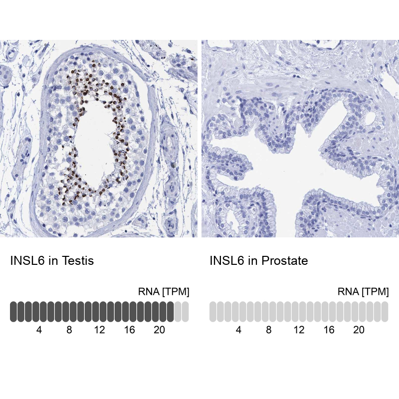 Anti-INSL6 Antibody