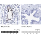 Anti-INSL6 Antibody