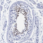 Immunohistochemical staining of human testis shows high expression.