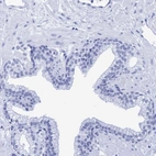 Immunohistochemical staining of human prostate shows low expression as expected.
