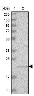 Lane 1: Marker [kDa] 230, 130, 95, 72, 56, 36, 28, 17, 11_br/_Lane 2: Human cell line RT-4