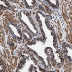 Anti-RAB34 Antibody