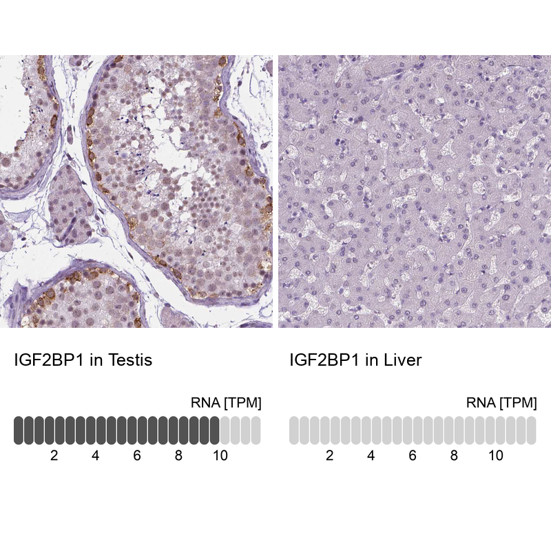 Anti-IGF2BP1 Antibody