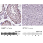 Anti-IGF2BP1 Antibody