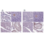 Immunohistochemical staining of human endometrium, ovary, pancreas and testis using Anti-IGF2BP1 antibody HPA021367 (A) shows similar protein distribution across tissues to independent antibody HPA062273 (B).