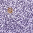 Immunohistochemical staining of human ovary shows moderate cytoplasmic positivity in follicle cells.