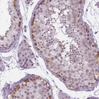 Immunohistochemical staining of human testis shows moderate cytoplasmic positivity in cells in seminiferous ducts.