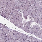 Immunohistochemical staining of human pancreas shows no positivity in exocrine glandular cells as expected.