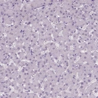 Immunohistochemical staining of human liver shows no positivity in hepatocytes as expected.