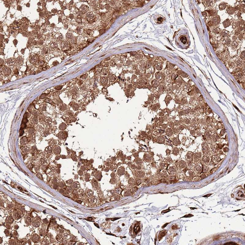 Anti-ADAMTS3 Antibody