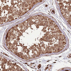 Anti-ADAMTS3 Antibody