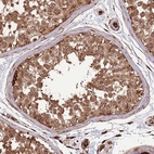 Anti-ADAMTS3 Antibody