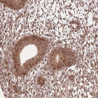 Immunohistochemical staining of human endometrium shows strong cytoplasmic positivity in glandular cells.