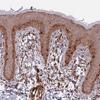 Immunohistochemical staining of human skin shows strong cytoplasmic positivity in squamous epithelial cells.