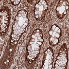 Immunohistochemical staining of human rectum shows strong cytoplasmic positivity in glandular cells.