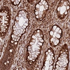 Immunohistochemical staining of human rectum shows strong cytoplasmic positivity in glandular cells.