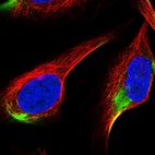 Immunofluorescent staining of human cell line U-2 OS shows localization to intermediate filaments.