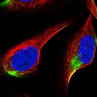 Immunofluorescent staining of human cell line U-2 OS shows localization to intermediate filaments.