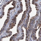 Immunohistochemical staining of human Fallopian tube shows strong membranous positivity in glandular cells.