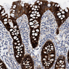 Immunohistochemical staining of human colon shows strong cytoplasmic positivity in glandular cells.