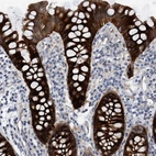 Immunohistochemical staining of human colon shows strong cytoplasmic positivity in glandular cells.