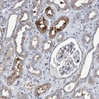 Immunohistochemical staining of human kidney shows moderate cytoplasmic positivity in cells in tubules.
