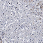 Immunohistochemical staining of human liver shows low positivity in hepatocytes as expected.