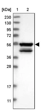 Lane 1: Marker [kDa] 230, 130, 95, 72, 56, 36, 28, 17, 11_br/_Lane 2: Human cell line RT-4