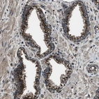Immunohistochemical staining of human prostate shows strong granular cytoplasmic positivity in glandular cells.