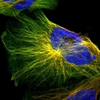 Immunofluorescent staining of human cell line U-251 MG shows localization to microtubules.