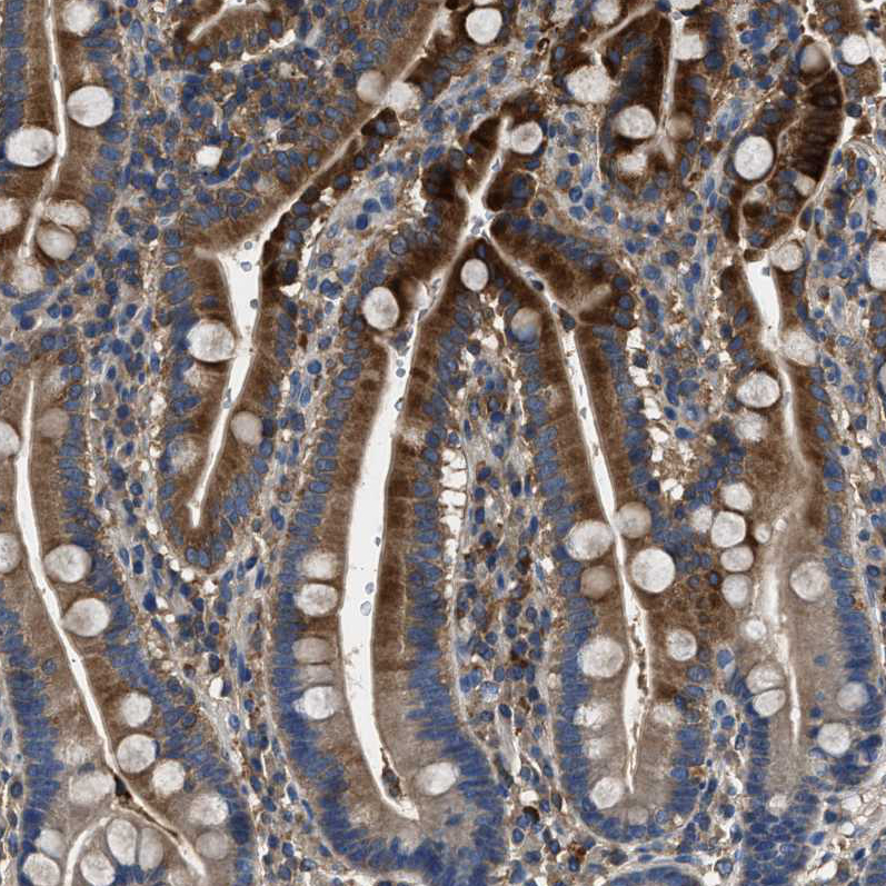 Anti-BLOC1S1 Antibody